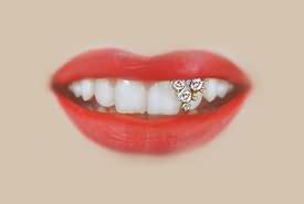 zahnschmuck